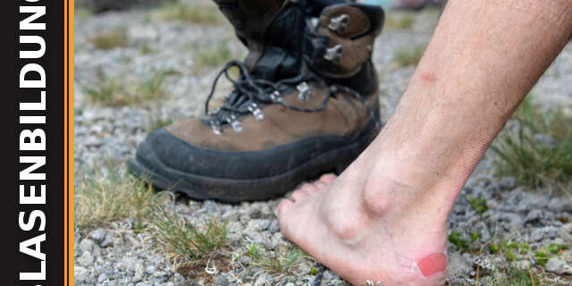 blasenbildung Blasen beim Wandern: Vorbeugen und behandeln